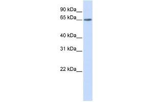 YTHDF3 antibody used at 1 ug/ml to detect target protein. (YTHDF3 antibody  (N-Term))