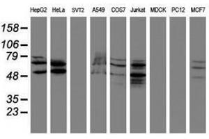 Image no. 2 for anti-SUMO1/sentrin/SMT3 Specific Peptidase 2 (SENP2) (AA 139-523) antibody (ABIN1490926) (SENP2 antibody  (AA 139-523))