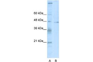 WB Suggested Anti-TSG101 Antibody Titration:  2. (TSG101 antibody  (C-Term))