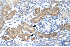 Rabbit Anti-L3MBTL2 Antibody Catalog Number: ARP30080 Paraffin Embedded Tissue: Human Kidney Cellular Data: Epithelial cells of renal tubule Antibody Concentration: 4. (L3MBTL2 antibody  (C-Term))