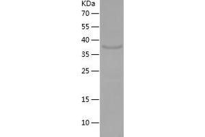 Western Blotting (WB) image for Fibroblast Growth Factor 22 (FGF22) (AA 23-170) protein (His-IF2DI Tag) (ABIN7283650) (FGF22 Protein (AA 23-170) (His-IF2DI Tag))
