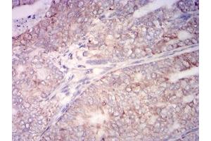 Immunohistochemistry (IHC) image for anti-Cytochrome C, Somatic (CYCS) (AA 1-105) antibody (ABIN7193451)