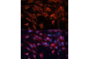 Immunofluorescence analysis of C6 cells using Cation-independent M6PR (Cation-independent M6PR (IGF2R)) antibody (ABIN6130063, ABIN6142247, ABIN6142248 and ABIN6216853) at dilution of 1:100. (IGF2R antibody  (AA 2327-2491))