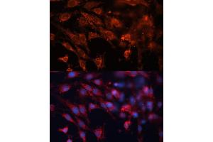 Immunofluorescence analysis of C6 cells using Cation-independent M6PR (Cation-independent M6PR (IGF2R)) antibody (ABIN6130063, ABIN6142247, ABIN6142248 and ABIN6216853) at dilution of 1:100.