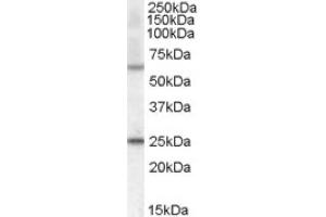 Image no. 1 for anti-Collagen, Type IV, alpha 3 (Goodpasture Antigen) Binding Protein (COL4A3BP) (Internal Region) antibody (ABIN374934) (COL4A3BP antibody  (Internal Region))