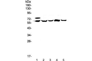 Western blot testing of 1) human HepG2, 2) rat liver, 3) rat lung, 4) mouse liver and 5) mouse lung lysate with Carboxylesterase 1 antibody at 0. (CES1 antibody)