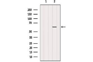 Western blot analysis of extracts from K562, using RCBTB1 Antibody.