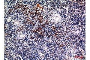 Immunohistochemistry (IHC) analysis of paraffin-embedded Human Tonsils, antibody was diluted at 1:100. (Syndecan 1 antibody  (Internal Region))