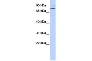 WB Suggested Anti-PLCD1 Antibody Titration: 0. (PLCD1 antibody  (N-Term))