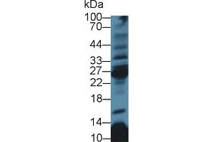 Western Blot; Sample: Rat Thymus lysate; Primary Ab: 3µg/ml Rabbit Anti-Human CD8b Antibody Second Ab: 0. (CD8B antibody  (AA 22-170))