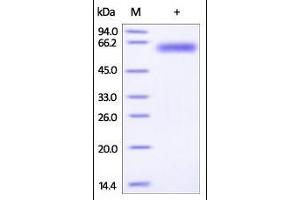 Mouse ROR1, His Tag on SDS-PAGE under reducing (R) condition. (ROR1 Protein (AA 30-403) (His tag))