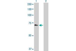 Western Blot analysis of CHEK2 expression in transfected 293T cell line by CHEK2 MaxPab polyclonal antibody. (CHEK2 antibody  (AA 1-543))