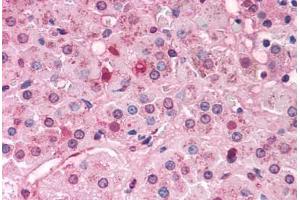 Immunohistochemistry (IHC) image for anti-Nuclear Receptor Subfamily 0, Group B, Member 1 (NR0B1) (C-Term) antibody (ABIN1048492)