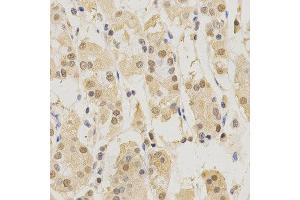 Immunohistochemistry of paraffin-embedded human stomach using PSMB5 antibody at dilution of 1:200 (x400 lens). (PSMB5 antibody  (AA 1-263))