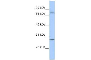 RCHY1 antibody used at 1 ug/ml to detect target protein. (RCHY1 antibody  (N-Term))