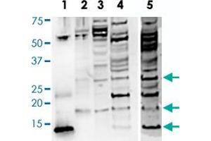 Western Blot analysis of (1) BDNF of rhBDNF R-088-100 (whole serum), (2) BDNF-isoform of rhBDNF R-088-100 (whole serum), (3) SHSY5Y of rhBDNF R-088-100 (whole serum), (4) Human brain of rhBDNF R-088-100 (whole serum), (5) Human brain of R-017-500 (IgG, 10 ug/mL), monomeric BDNF at 14 kDa and proBDNF is detected at the expected molecular weight of 32 kDa for glycosylated proBDNF monomer. (BDNF antibody)