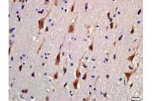 Formalin-fixed and paraffin embedded rat brain labeled with Rabbit Anti-KIBRA Polyclonal Antibody, Unconjugated (ABIN1387477) at 1:200 followed by conjugation to the secondary antibody and DAB staining (WWC1 antibody  (AA 351-450))