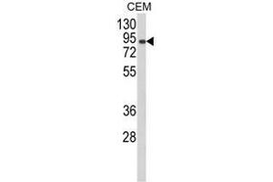 Western blot analysis of AOC3 Antibody (Center) in CEM cell line lysates (35ug/lane). (AOC3 antibody  (Middle Region))