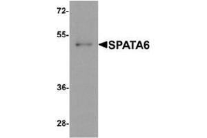 Western blot analysis of SPATA6 in A20 cell lysate with SPATA6 Antibody  at 1 µg/ml. (SPATA6 antibody  (C-Term))