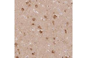 Immunohistochemical staining (Formalin-fixed paraffin-embedded sections) of human cerebral cortex with MAP1LC3A polyclonal antibody  shows strong cytoplasmic and nuclear positivity in neuronal cells. (MAP1LC3A antibody)
