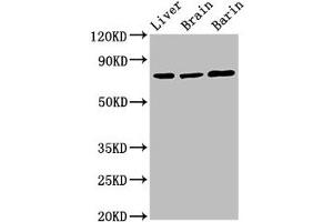 Western Blot Positive WB detected in: Rat liver tissue, Rat brain tissue, Mouse brain tissue All lanes: Hspa5 antibody at 3 μg/mL Secondary Goat polyclonal to rabbit IgG at 1/50000 dilution Predicted band size: 73 kDa Observed band size: 73 kDa (GRP78 antibody  (AA 20-655))