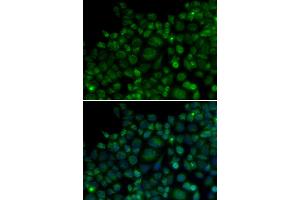 Immunofluorescence analysis of MCF-7 cells using TLR7 antibody (ABIN5970379). (TLR7 antibody)