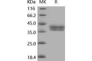 Western Blotting (WB) image for Carbonic Anhydrase 12 (CA12) (Active) protein (His tag) (ABIN7194556) (CA12 Protein (His tag))