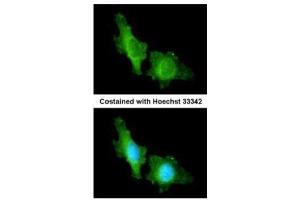 ICC/IF Image Immunofluorescence analysis of methanol-fixed HeLa, using CNGA2, antibody at 1:200 dilution. (CNGA2 antibody  (C-Term))