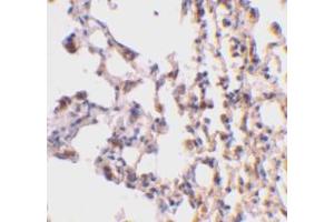 Immunohistochemical staining of mouse lung tissue using AP30147PU-N Bid antibody at 2 μg/ml. (BID antibody  (C-Term))