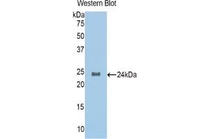 Western blot analysis of the recombinant protein. (NAGA antibody  (AA 218-411))