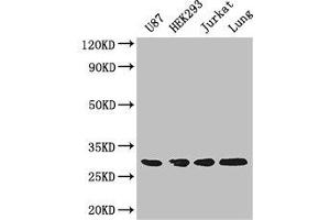Western Blot Positive WB detected in: U87 whole cell lysate, HEK293 whole cell lysate, Jurkat whole cell lysate, Mouse lung tissue All lanes: LASP1 antibody at 4 μg/mL Secondary Goat polyclonal to rabbit IgG at 1/50000 dilution Predicted band size: 30, 37, 24 kDa Observed band size: 30 kDa (LASP1 antibody  (AA 128-252))