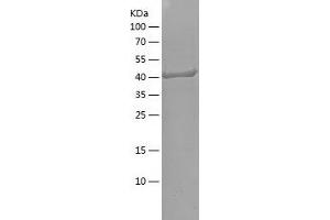 Western Blotting (WB) image for Second Mitochondria-Derived Activator of Caspase (DIABLO) (AA 61-239) protein (His-IF2DI Tag) (ABIN7282214) (DIABLO Protein (AA 61-239) (His-IF2DI Tag))