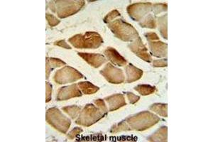 Immunohistochemistry (IHC) image for anti-Cathepsin F (CTSF) antibody (ABIN3002689) (Cathepsin F antibody)