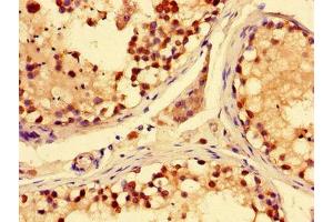 Immunohistochemistry of paraffin-embedded human testis tissue using ABIN7170219 at dilution of 1:100 (SLC28A3 antibody  (AA 1-102))