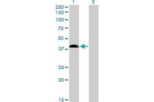 Western Blot analysis of MGC26963 expression in transfected 293T cell line by MGC26963 monoclonal antibody (M08), clone 7D10. (Sphingomyelin Synthase 2 antibody  (AA 2-80))