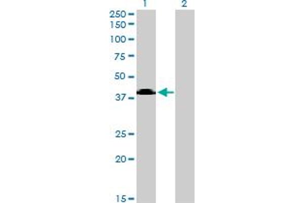 Sphingomyelin Synthase 2 antibody  (AA 2-80)