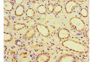 Immunohistochemistry of paraffin-embedded human kidney tissue using ABIN7147518 at dilution of 1:100 (CHMP1B antibody  (AA 1-199))