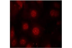 Image no. 3 for anti-Forkhead Box O4 (FOXO4) (pSer197) antibody (ABIN196850) (FOXO4 antibody  (pSer197))