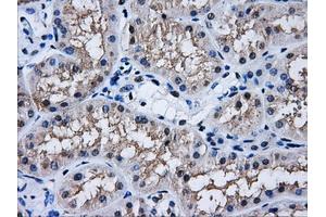 Immunohistochemical staining of paraffin-embedded Kidney tissue using anti-AKR1A1mouse monoclonal antibody. (AKR1A1 antibody)