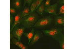 IF analysis of SMC2 and Tubulin beta using anti-SMC2 antibody (ABIN7601453) and anti-Tubulin beta antibody (ABIN7602744). (SMC2 antibody  (AA 359-1071))