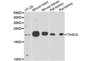 Western blot analysis of extracts of various cell lines, using TAGLN antibody. (Transgelin antibody  (AA 1-201))