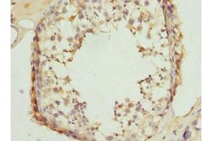 Immunohistochemistry of paraffin-embedded human testis tissue using ABIN7147935 at dilution of 1:100 (CLASP1 antibody  (AA 1389-1538))