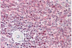 Human Spleen: Formalin-Fixed, Paraffin-Embedded (FFPE) (IST1 antibody  (AA 125-317))