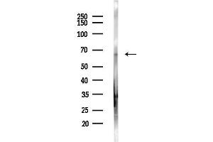 anti-Membrane Protein, Palmitoylated 2 (MAGUK P55 Subfamily Member 2) (MPP2) antibody