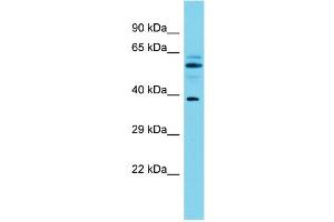 Host: Rabbit Target Name: MACROD1 Sample Type: Fetal Brain lysates Antibody Dilution: 1. (MACROD1 antibody  (N-Term))