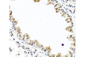Immunohistochemistry of paraffin-embedded Mouse lung using TET2 Polyclonal Antibody at dilution of 1:100 (40x lens). (TET2 antibody)