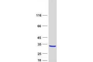 Validation with Western Blot (RAB37 Protein (Transcript Variant 3) (Myc-DYKDDDDK Tag))