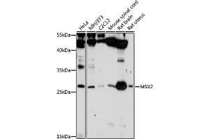Western blot analysis of extracts of various cell lines, using MSX2 antibody (ABIN3015838, ABIN3015839, ABIN3015840 and ABIN6219185) at 1:1000 dilution.