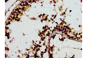 Immunohistochemistry of paraffin-embedded human testis tissue using ABIN7148001 at dilution of 1:100 (F13A1 antibody  (AA 380-520))