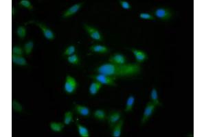 Immunofluorescence staining of Hela cells with ABIN7161047 at 1:166, counter-stained with DAPI. (NRD1 antibody  (AA 32-113))